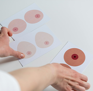 Реконструкція ареол і сосків