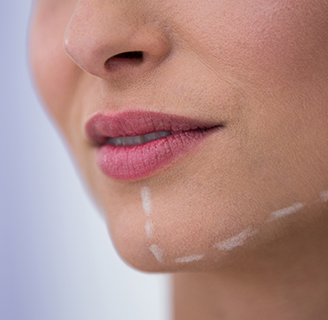 Корекція розміру та форми підборіддя