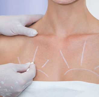 Підтяжка молочних залоз