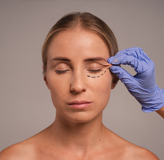 Блефаропластика