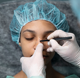 Ринопластика