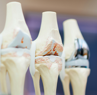 Видалення металоконструкцій