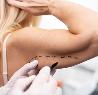 Відновлення молодості рук