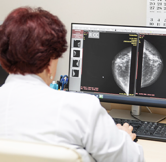 Мамографія