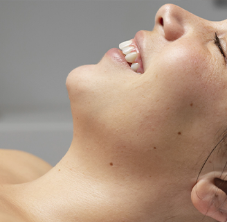 Ліпосакція підборіддя