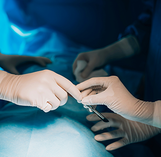 Розкриття підшкірного парапроктита